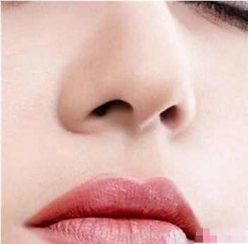 鼻翼缩小术对比果明显吗?手术应该如何选择医院呢?价格贵不贵?