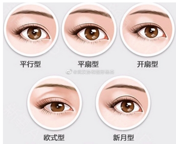 协和医院朱琳双眼皮案例公布!今日案例全切双眼皮!让眼周实现年轻化~