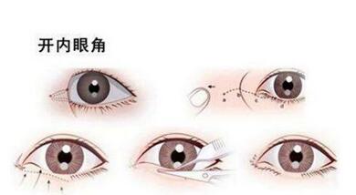 ayuki整容是真的吗?前后对比照!