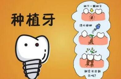 上海亿大口腔医院怎么样?是静安区种牙收费公道,医生技术上道!