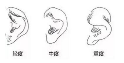 西京医院郭树忠的图片来袭!内含归来医生简介以及双眼皮真人!