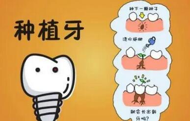 北京天坛医院种植牙多少钱?来看看具体的分享!