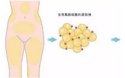 重庆张劲医生擅长项目有哪些?价格表和医院信息一览!