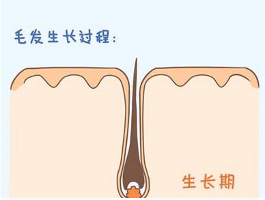 种植头发一般多少钱啊?做完植发后如何护理头皮
