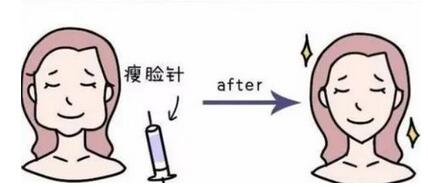 有没有副作用?注射瘦脸副作用详情|如何做术后恢复?
