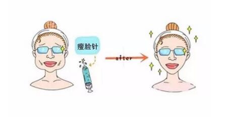 有没有副作用?注射瘦脸副作用详情|如何做术后恢复?