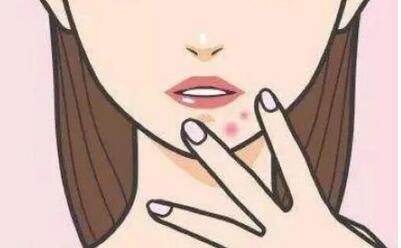 下巴长痘痘红肿硬硬的还疼怎么解决?痘痘消除方法和原因这里有!