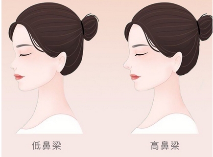 北京鼻部整形哪家医院好?润美玉之光、华美、薇琳等都很nice!特色鲜明~
