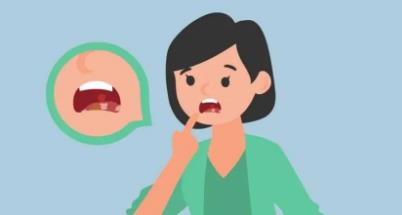 5个小妙招巧治口腔溃疡,你了解吗?