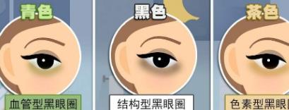 怎么样消除黑眼圈,可以通过热敷,补水护理等等?