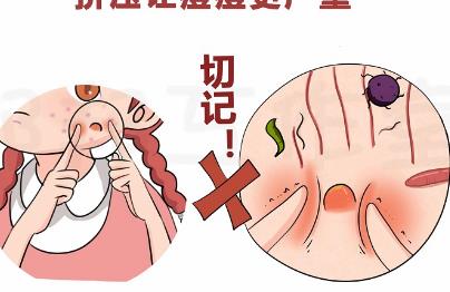 面部痤疮调节方案,可以通过口服药物,手术调节等等!