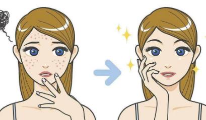 如何快速去痘印,如何正确的使用?