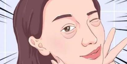 眼袋手术易出现哪些后遗症?详细清单,必了解戳进来!
