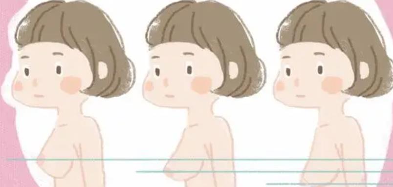 下垂怎么办?下垂分几种情况呢?如何改良