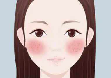 重庆美莱整形美容医院褪红血丝多少钱?内附真人案例图展示!