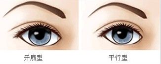 李天石双眼皮过宽修复案例图参考:线条流畅、灵动双眼皮很迷人！