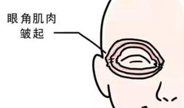 去除鱼尾纹用什么手术?如何护理自己的皮肤?戳进来看