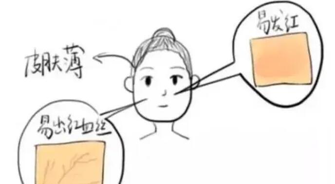 鼻翼两侧有红血丝怎么办?有什么好的调节方法?