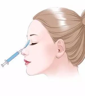 注射隆鼻种类有哪些?胶原蛋白、玻尿酸、自体脂肪测评!