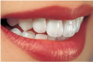 冷光牙齿美白对牙齿伤害有多大？修复牙齿是方式有哪些？原理是怎么样的呢？ 
