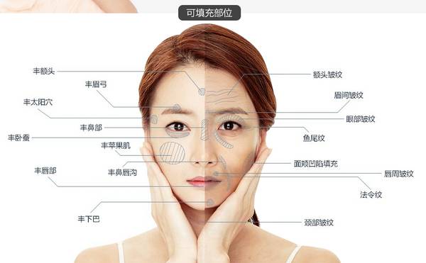 深圳贝加美陈孟春医生怎么样?个人简介、太阳穴填充案例反馈!