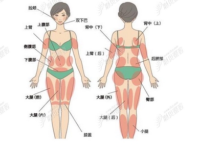 腹部吸脂痛吗?优势弊端有这些!转给身边减肥的朋友~