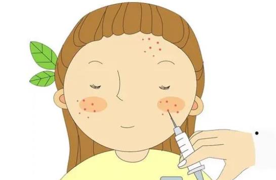 白瓷娃娃激光有什么美肤作用?白瓷娃娃的优势是什么?术后护理