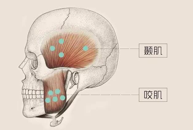 咬肌怎么变小?注射和切除哪种方式好?风险和效果介绍!