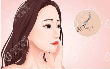 奥美定隆鼻有什么副作用?注意事项有哪些?附价格介绍~