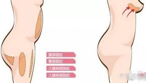 中信惠州医院美容科怎么样?特色项目更新,看看你还不知道哪些呢?