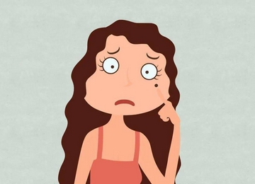 山东省立医院张健医生痣切除怎么样?真人经典案例介绍!附医生简介~