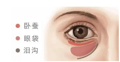 华西医院肖海涛祛眼袋怎么样?眼袋不在,青春自来!祛眼袋案例分享~
