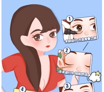 华西医院肖海涛祛眼袋怎么样?眼袋不在,青春自来!祛眼袋案例分享~