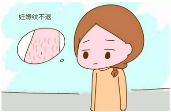 去妊娠纹有果的方法有哪些?掌握4个方法帮助淡化妊娠纹!妙招都很实用~