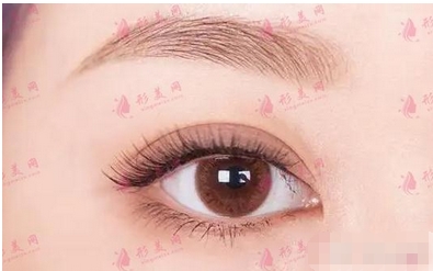 苏薇洁修复双眼皮厉害还是余东?医生资料详细对比,从整形案例、资质来比较!
