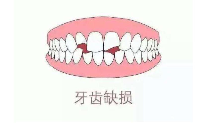 老人全口假牙多少钱一副?价目表2023一览-注意事项汇总!