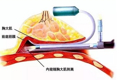 可玫尔医疗美容医院怎么样?医院实力,医生口碑技术快速get!