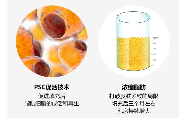 成都蓉美和谐医院怎么样?赵兴阳医生简介-脂肪丰胸案例