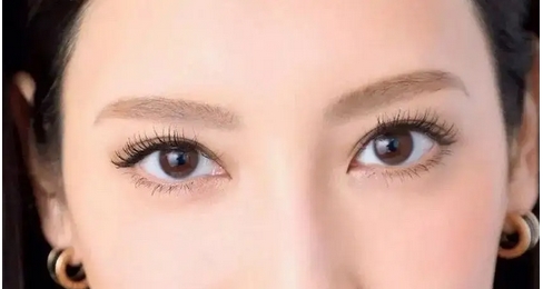 双眼皮之后出现三眼皮能恢复吗?埋线、微创-全切看看那种更适合你~