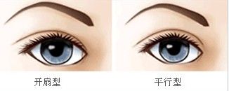 睿本医疗美容门诊部怎么样?资质口碑简介-双眼皮案例解析