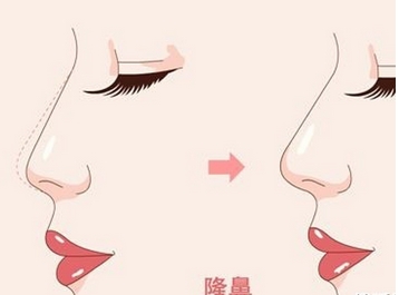 深圳美莱医疗美容医院正规吗?医院医生拥有深厚的造诣!实现美丽蜕变~