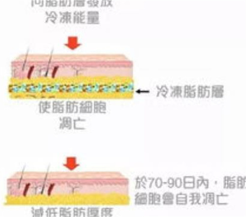 八大处吕倩雯吸脂价格怎么样?医生个人资料公开,看实力咋样?