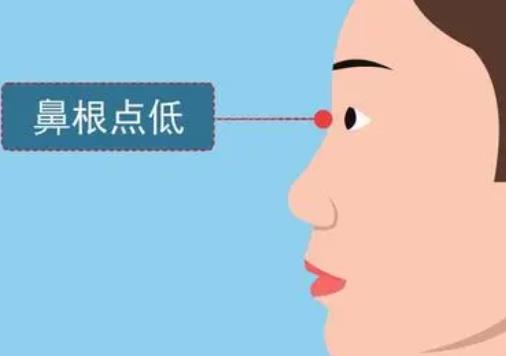 广州曙光医美美容医院怎么样?医生团队介绍,假体隆鼻案例分享