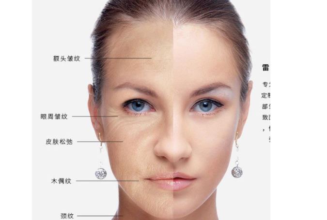 全脸提升多少钱一次?有什么危害?可以保持几年?