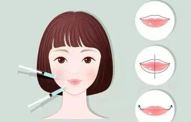 孙维绎医生m唇术案例图来袭!前后差太大了!