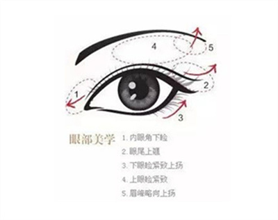 王志国做眼综合怎么样?眼综合案例曝光,真人分享!