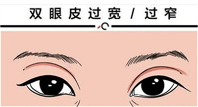 八大处刘力强做双眼皮怎么样?医生的技术可靠吗?基本介绍!