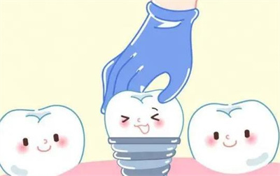 上海极橙齿科种植牙怎么样?技术分析,医生介绍