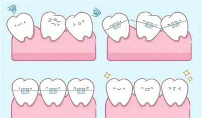 上海伟德口腔门诊可以用医保吗?真实案例分享+新价格表