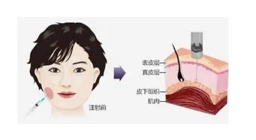 南京美贝尔美容医院打瘦脸多少钱?价格费用明细_近期案例图详情